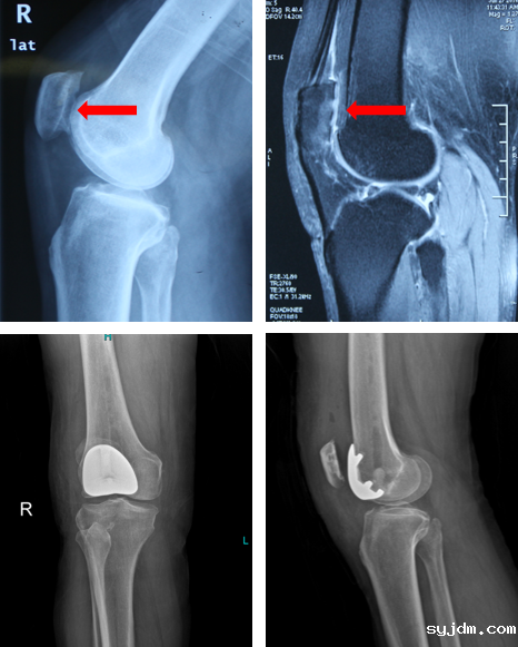 01e851e31e094c5cb431e8ab753a8687.png 01e851e31e094c5cb431e8ab753a8687.png