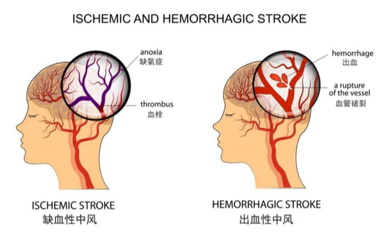 119fc6f2acc34c258ee3560dc4b812a0.png 119fc6f2acc34c258ee3560dc4b812a0.png