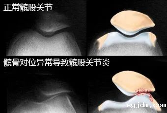 e875377b15654a83b572aade6bea8bcf.jpg e875377b15654a83b572aade6bea8bcf.jpg